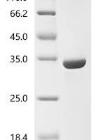 Helicobacter pylori Neuraminyllactose-binding hemagglutinin (hpaA) Recombinant Protein - BioCrest Sci