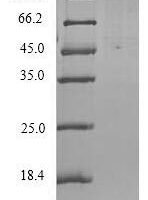 Human Orexin receptor type 2 (HCRTR2), partial Recombinant Protein, N-His-tagged/Tag-Free - BioCrest Sci