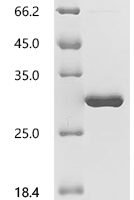 Human Ras-related C3 botulinum toxin substrate 1 (RAC1) Recombinant Protein, N-10His - BioCrest Sci