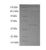 Human Coactosin-like protein (COTL1) Recombinant Protein, Homo sapiens (Human), E.coli, N-terminal 6xHis-SUMO-tagged, 31.8 kDa, purity >≥ 90% as determined by SDS-PAGE.