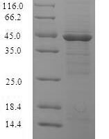 Vibrio parahaemolyticus serotype O3:K6 Outer membrane protein ompK (ompK) Recombinant Protein - BioCrest Sci