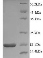 Human Neurotrophin-4 (NTF4), partial Recombinant Protein - BioCrest Sci