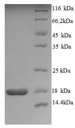 Human Neurotrophin-4 (NTF4), partial Recombinant Protein, Homo sapiens (Human), E.coli, N-terminal 6xHis-tagged, 17.9 kDa, purity >≥ 90% as determined by SDS-PAGE.