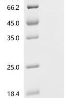 Simian retrovirus SRV-2 Gag polyprotein (gag), partial Recombinant Protein, C-His, aa 2–100, Yeast - BioCrest Sci