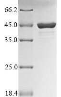 Influenza B virus Nucleoprotein (NP), partial Recombinant Protein, N-GST - BioCrest Sci