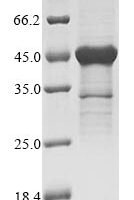Human 40S ribosomal protein S3 (RPS3) Recombinant Protein - BioCrest Sci