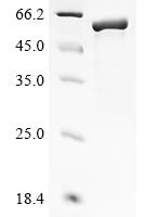 Human Inactive cytidine monophosphate-N-acetylneuraminic acid hydroxylase (CMAHP) Recombinant Protein - BioCrest Sci