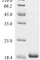 Cyprinus carpio Parvalbumin (cyp c 1.01) Recombinant Protein - BioCrest Sci