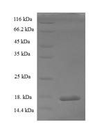 Rat Potassium voltage-gated channel subfamily E member 2 (Kcne2) Recombinant Protein, Rattus norvegicus (Rat), E.coli, N-terminal 6xHis-tagged, 18.4 kDa, purity >≥ 90% as determined by SDS-PAGE.