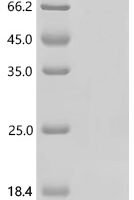 Mouse Heat shock protein HSP 90-alpha (Hsp90aa1) Recombinant Protein - BioCrest Sci