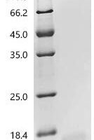 Human NADH dehydrogenase [ubiquinone] 1 alpha subcomplex subunit 5 (NDUFA5) Recombinant Protein, N-His - BioCrest Sci