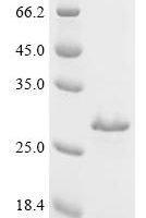 Mycobacterium tuberculosis Cell surface glycolipoprotein MPT83 (mpt83) Recombinant Protein - BioCrest Sci