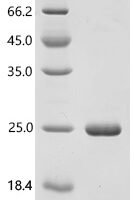 Cat Hemoglobin subunit alpha (HBA) Recombinant Protein - BioCrest Sci