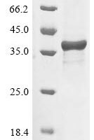 Brugia malayi tRNA (guanine-N (7)-)-methyltransferase (Bm1_01445) Recombinant Protein - BioCrest Sci