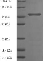 Human Platelet glycoprotein Ib alpha chain (GP1BA), partial Recombinant Protein, N-His - BioCrest Sci