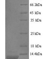 Conus striatus Con-ikot-ikot Recombinant Protein, N-His, aa 38–123, Yeast - BioCrest Sci