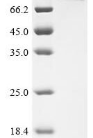 Rat Protein kinase C-binding protein NELL1 (Nell1) Recombinant Protein - BioCrest Sci