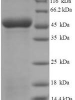 Human Antigen-presenting glycoprotein CD1d (CD1D), partial Recombinant Protein - BioCrest Sci