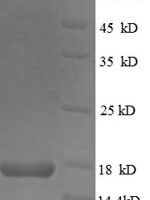 Human TeRatocarcinoma-derived growth factor 1 (TDGF1), partial Recombinant Protein, N-His - BioCrest Sci