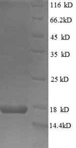 Human TeRatocarcinoma-derived growth factor 1 (TDGF1), partial Recombinant Protein, N-His, Homo sapiens (Human), E.coli, N-terminal 6xHis-tagged, 17.5 kDa, purity >≥ 90% as determined by SDS-PAGE.
