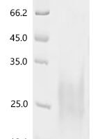 Anguilla japonica Ventricular natriuretic peptide (vnp) Recombinant Protein, C-His, aa 115–150, Yeast - BioCrest Sci