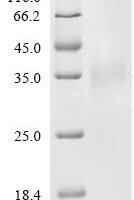Human Insulin-like growth factor-binding protein 3 receptor (TMEM219), partial Recombinant Protein, C-10His - BioCrest Sci