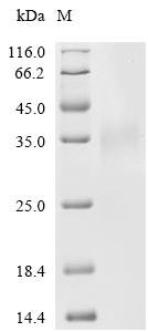 Human Insulin-like growth factor-binding protein 3 receptor (TMEM219), partial Recombinant Protein, C-10His, Mammalian cell, C-terminal 10xHis-tagged, 20.4 kDa, purity >≥ 85% as determined by SDS-PAGE.
