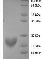 Human Putative RNA-binding protein 3 (RBM3) Recombinant Protein, N-His - BioCrest Sci