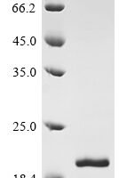 Human Ribonuclease 7 (RNASE7) Recombinant Protein, N-His - BioCrest Sci