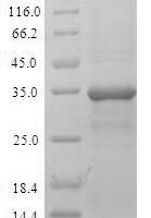 Human Malignant T-cell-amplified sequence 1 (MCTS1) Recombinant Protein - BioCrest Sci