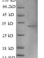 Human Metallothionein-1A (MT1A), partial Recombinant Protein, N-GST - BioCrest Sci