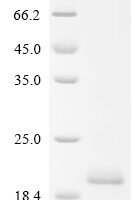 Human Sushi, von Willebrand factor type A, EGF and pentraxin domain-containing protein 1 (SVEP1), partial Recombinant Protein - BioCrest Sci