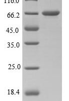 Clostridium tetani Tetanus toxin (tetX), partial Recombinant Protein, N-His-B2M - BioCrest Sci