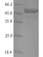 Human Myosin-binding protein C, fast-type (MYBPC2), partial Recombinant Protein, N-His, aa 739–1141, E.coli - BioCrest Sci