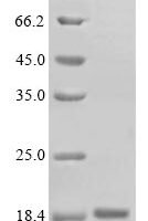 Rat Thyrotropin subunit beta (Tshb) Recombinant Protein, N-10His/C-Myc - BioCrest Sci