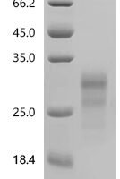 Macaca mulatta Interferon gamma (IFNG), Biotinylated Recombinant Protein - BioCrest Sci
