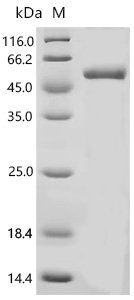 Pig Scavenger receptor cysteine-rich type 1 protein M130 (CD163), partial Recombinant Protein, C-His, Sus scrofa (Pig), E.coli, C-terminal 6xHis-tagged, 53.1 kDa, purity >≥ 85% as determined by SDS-PAGE.