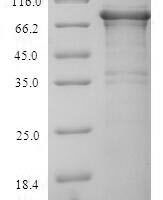 Human Replication protein A 70 kDa DNA-binding subunit (RPA1) Recombinant Protein - BioCrest Sci