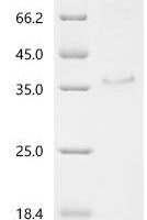 Human Protein KPLCE (KPLCE) Recombinant Protein - BioCrest Sci