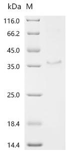 Human Protein KPLCE (KPLCE) Recombinant Protein, Homo sapiens (Human), E.coli, C-terminal 6xHis-tagged, 33.2 kDa, purity >≥ 85% as determined by SDS-PAGE.