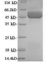 Human 11-beta-hydroxysteroid dehydrogenase type 2 (HSD11B2) Recombinant Protein - BioCrest Sci