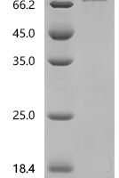 Macaca fascicularis CD226 antigen (CD226), partial, Biotinylated Recombinant Protein - BioCrest Sci