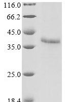 Human adenovirus B serotype 11 Fiber protein (L5) Recombinant Protein - BioCrest Sci