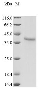 Human adenovirus B serotype 11 Fiber protein (L5) Recombinant Protein, Human adenovirus B serotype 11 (strain BC34) (HAdV-11) (Human adenovirus 11A (strain BC34)), Yeast, N-terminal 10xHis-tagged, 37.8 kDa, purity >≥ 85% as determined by SDS-PAGE.