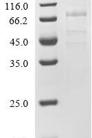 Human Endothelial lipase (LIPG) Recombinant Protein, C-10His - BioCrest Sci