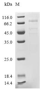 Human Endothelial lipase (LIPG) Recombinant Protein, C-10His, Homo sapiens (Human), Mammalian cell, C-terminal 10xHis-tagged, 56.3 kDa, purity >≥ 85% as determined by SDS-PAGE.