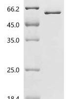 Mouse SH3 and cysteine-rich domain-containing protein 3 (Stac3) Recombinant Protein - BioCrest Sci