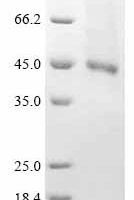 Human Receptor-type tyrosine-protein kinase FLT3 (FLT3), partial Recombinant Protein - BioCrest Sci