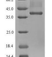 Mouse Ubiquitin-protein ligase E3A (Ube3a), partial Recombinant Protein, N-His, aa 542–870, E.coli - BioCrest Sci