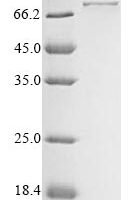 Meleagris gallopavo Acrosin (ACR) Recombinant Protein, N-MBP/C-His - BioCrest Sci